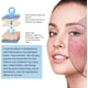 thumbnail image 3 of Kit de Microinfusión para Rostro y Labios con Suero Facial para una Piel Suave, 3 of 9