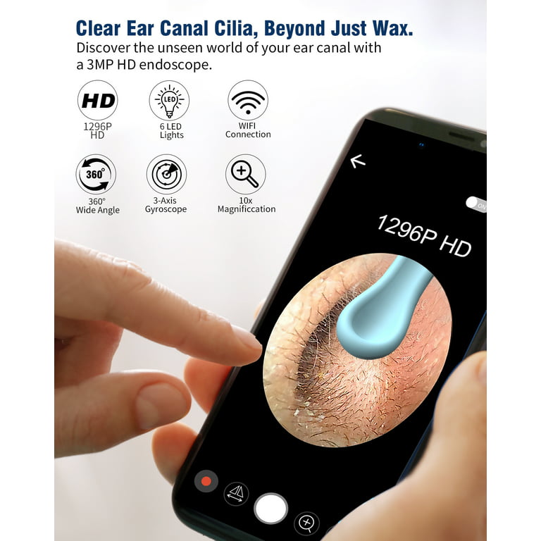 Ear Wax Removal, Ear Wax Removal Tool with 1296P HD Camera and 6