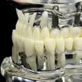thumbnail image 5 of Dental Model Teeth Implant Restoration Bridge Teaching for Study Tooth Science, 5 of 5