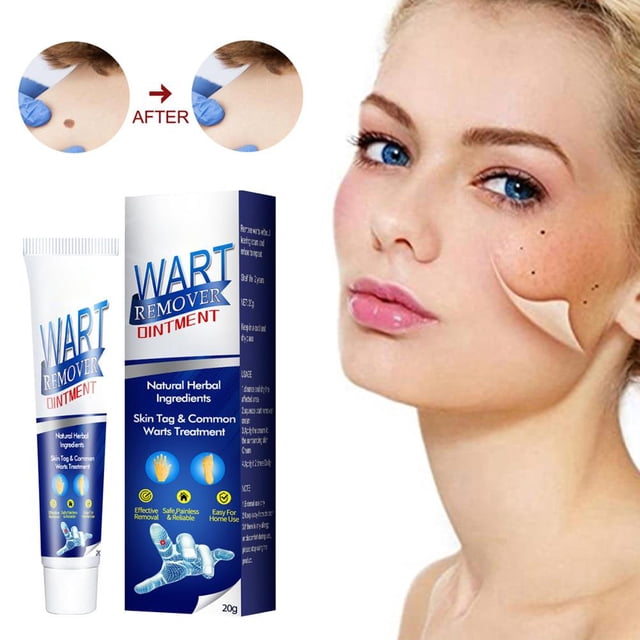 Eliminador de marcas en la piel, pomada eliminadora de verrugas, fácil de llevar para toda la piel, crema eficiente para eliminar lunares
