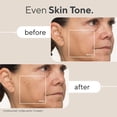 thumbnail image 3 of TheraFace Mask LED Light Therapy Skin Care Face Mask with Vibrating Massage - FSA Eligible Blue & Red Light Therapy for Face - LED Face Mask Facial Massager for Wrinkles, Skin Tightening & Dark Spots, 3 of 5