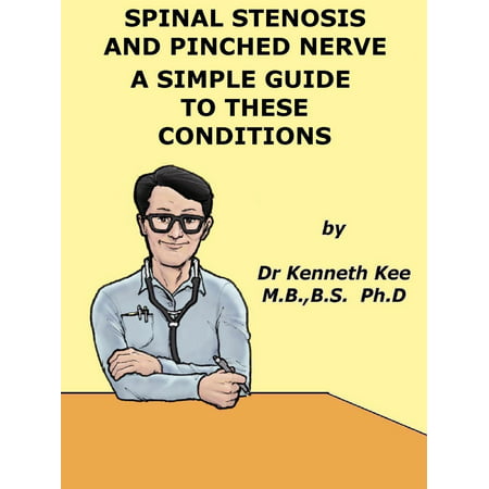Spinal Stenosis And Pinched Nerve A Simple Guide to These conditions - (Best Way To Treat A Pinched Nerve In Shoulder)