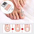thumbnail image 4 of Ingrown Nail Corrector, Exfoliate Dead Skin Toenail Correction Patch Lightweight Professional Design  For   For Toenail, 4 of 8
