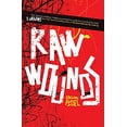 thumbnail image 2 of Raw Wounds, 2 of 2