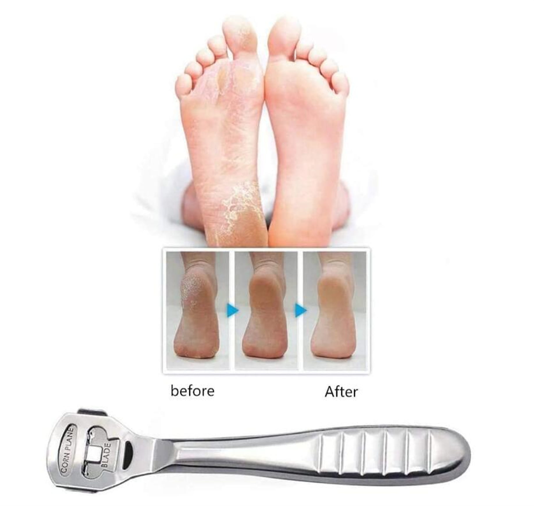 Foot Scraper for Dead Skin, Heel Scraper Care Callus for Feet - Stainless Steel Foot File and Shaver Callus Remover Tool Set with 10 Replaceable