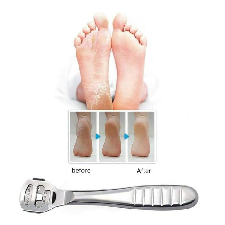 TALITARE Foot Scraper with Replacement Premium Plastic Foot Care Pedicure  Kit Set Tool Dead Hard Skin Callus Remover Foot Rasp for Foot Hand Caring  Remove Solid Cracked Skin Wet Dry Feet price