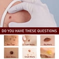 thumbnail image 4 of Remover Fast Remove All Moles Warts Spots Freckles Foot Corn Removal Warts Papillomas Rapidly Remove Moles 3ml, 4 of 4