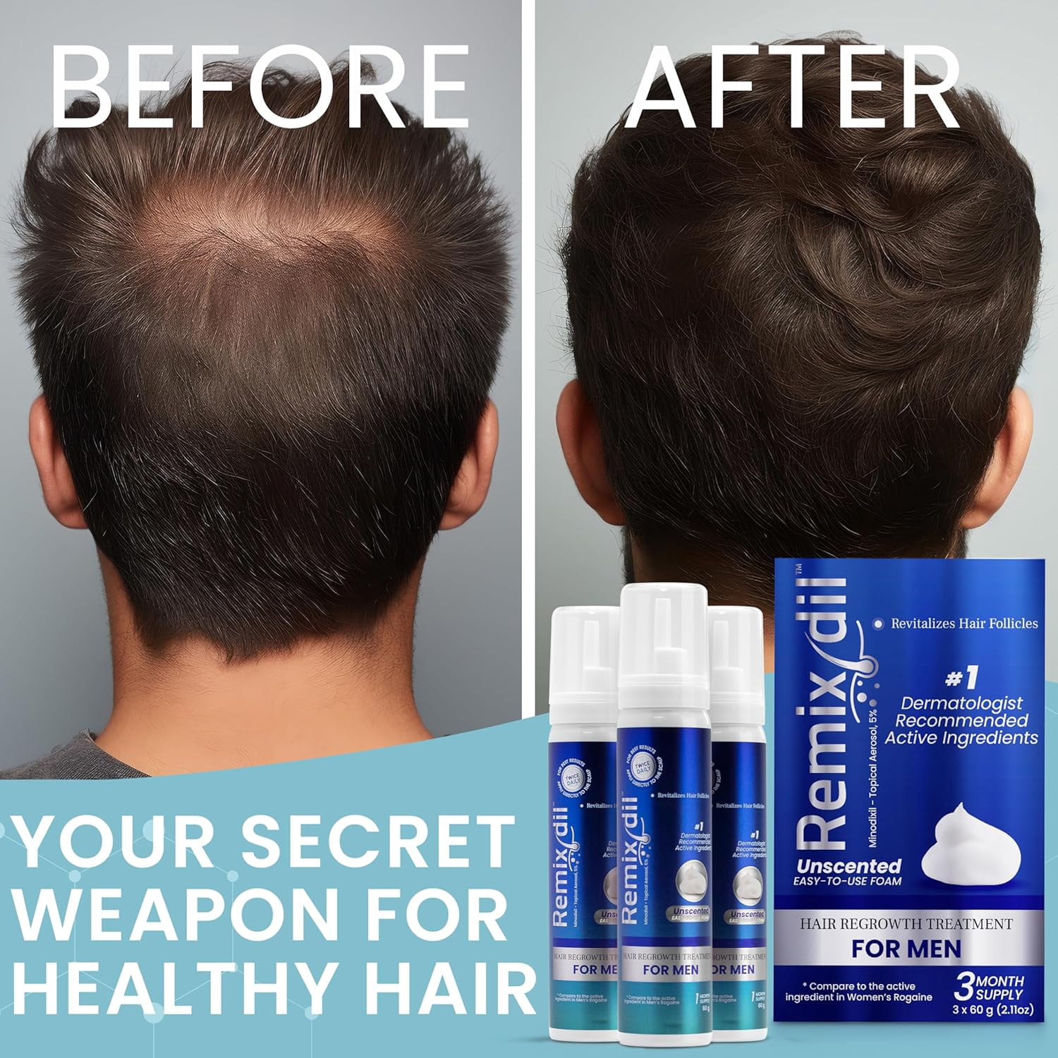 Men’s 5% Scalp Solution | Daily Leave-On Treatment for Thicker, Fuller-Looking Hair