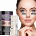 thumbnail image 1 of Double Eyelid Styling Double Eyelid Sticker Set Invisible Natural Lasting B, 1 of 5