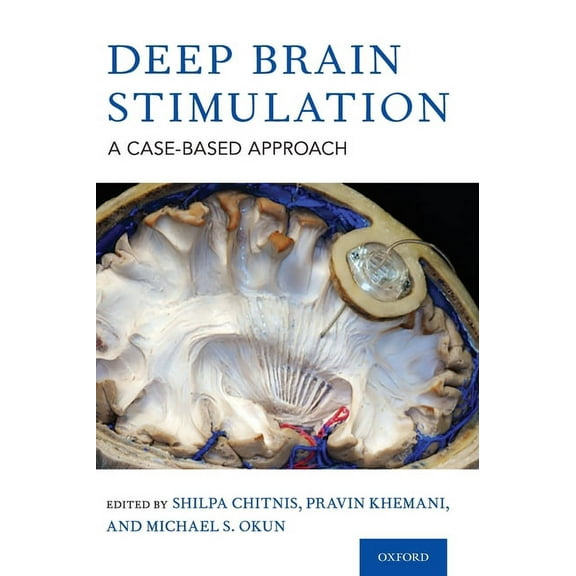 Deep Brain Stimulation: A Case-Based Approach, (Hardcover)