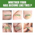 thumbnail image 4 of South Moon Nail Care Roller Balls - Nourishing Massage For Stronger, Faster-growing Nails With 7-day Nail Growth Formula, 4 of 5