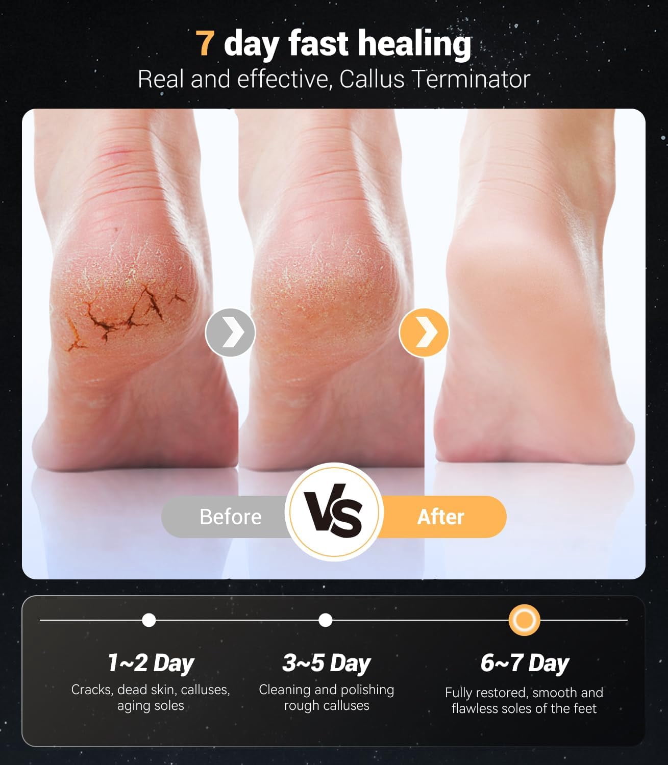 Electric Foot Callus Remover,Rechargeable Electric Callus Remover for Feet Variable 3-Speed & LED Light Portable Foot File Pedicure Kits with 30 Grit Pads