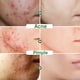 thumbnail image 2 of Crema Facial reafirmante de Lifting instantáneo, eliminador de arrugas, antienvejecimiento, desvanecimiento de líneas finas, herramienta Facial para el cuello, blanqueamiento, nutre la piel seca"one" Fivean LED, 2 of 2