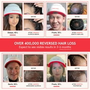 iRestore Professional 282 | FDA Cleared Laser Hair Growth Device | Red Light Therapy for Hair Growth | Laser Cap for Hair Regrowth, Restore Laser Helmet, Hair Loss Treatments for Men & Women Alopecia
