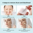 thumbnail image 5 of Blackhead Remover Tool, Blackhead Extractor tool for Face, Extractor Tool for Zit Acne, 5 of 5