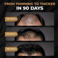 thumbnail image 2 of 1-3x SPARTAN Root Activator Shampoo For Men - Hair Growth Shampoo for Hair Loss and Thinning Hair, 2 of 5