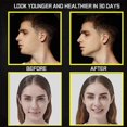thumbnail image 5 of Silicone Jaw Exerciser - 3 Resistance Levels (6pcs), 5 of 5