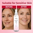 thumbnail image 5 of Reviva Labs Rosewater Facial Spray - Hydrating Face Mist for All Skin Types, 8 Fl Oz (3-Pack), 5 of 7