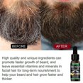thumbnail image 2 of Aceite para el crecimiento de la barba Spray hidratante reafirmante Cuidado de la barba para promover el crecimiento de la barba Líquido denso, 2 of 3