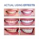 thumbnail image 5 of 120g Sp-6 Probiotics Brightening White Toothpaste Tooth, 5 of 5