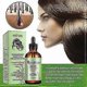 thumbnail image 3 of Aceite fortalecedor para el cuero cabelludo y el cabello con romero y menta, biotina y aceites esenciales, tratamiento nutritivo, 3 of 4