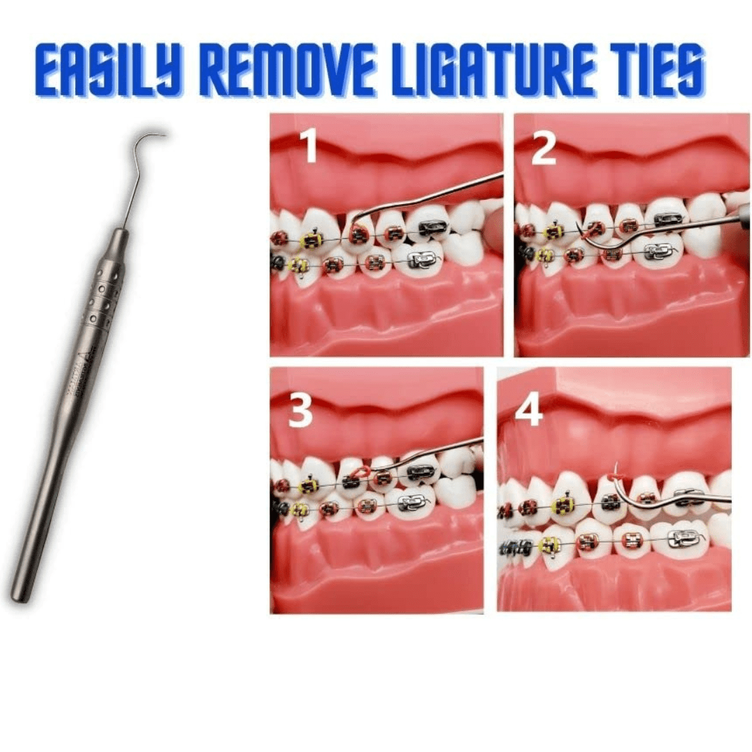 Buy Braces Ligature Ties Removal Color Changing Tool Probe by Artman