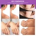 thumbnail image 3 of Parche para heridas por quemaduras, ligero, 4 Uds., accesorios multifuncionales para la piel de Gel de silicona Likrtyny Cuidado Belleza, 3 of 4