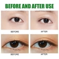 thumbnail image 4 of Cinta De Doble Párpado 396PCS Big Eye Tools Tiras de levantamiento de párpados de 3 formas para tapas caídas para ojos con capucha Wdftyju  Cuidado Belleza, 4 of 5
