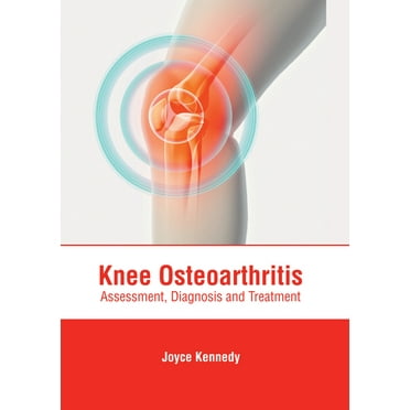 Knee Osteoarthritis: Assessment, Diagnosis and Treatment (Hardcover)