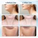 thumbnail image 4 of Facial Massager, 7 in 1 Facial Massager, Face Contouring Tool with Heat and, 4 of 5