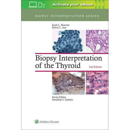 UPC: 9781496355850 | Biopsy Interpretation: Biopsy Interpretation of the Thyroid (Hardcover)