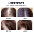thumbnail image 5 of 1-3 piezas de spray para el crecimiento del cabello que promueve el crecimiento grueso del cabello, líquido para el tratamiento del cuero cabelludo dañado, masaje reparador, suero anticaída y anticaíd, 5 of 5