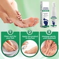 thumbnail image 3 of Foot Spray with Tea Tree Oil, 2026 New Tea Tree Oil Foot Spray, Feet Spray for Foot & Shoe Freshness, Quick-Drying and Travel-Friendly (2PCS), 3 of 7