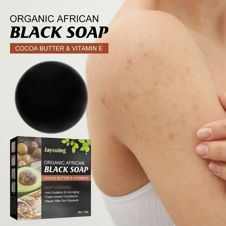 Soap for acne on back deals
