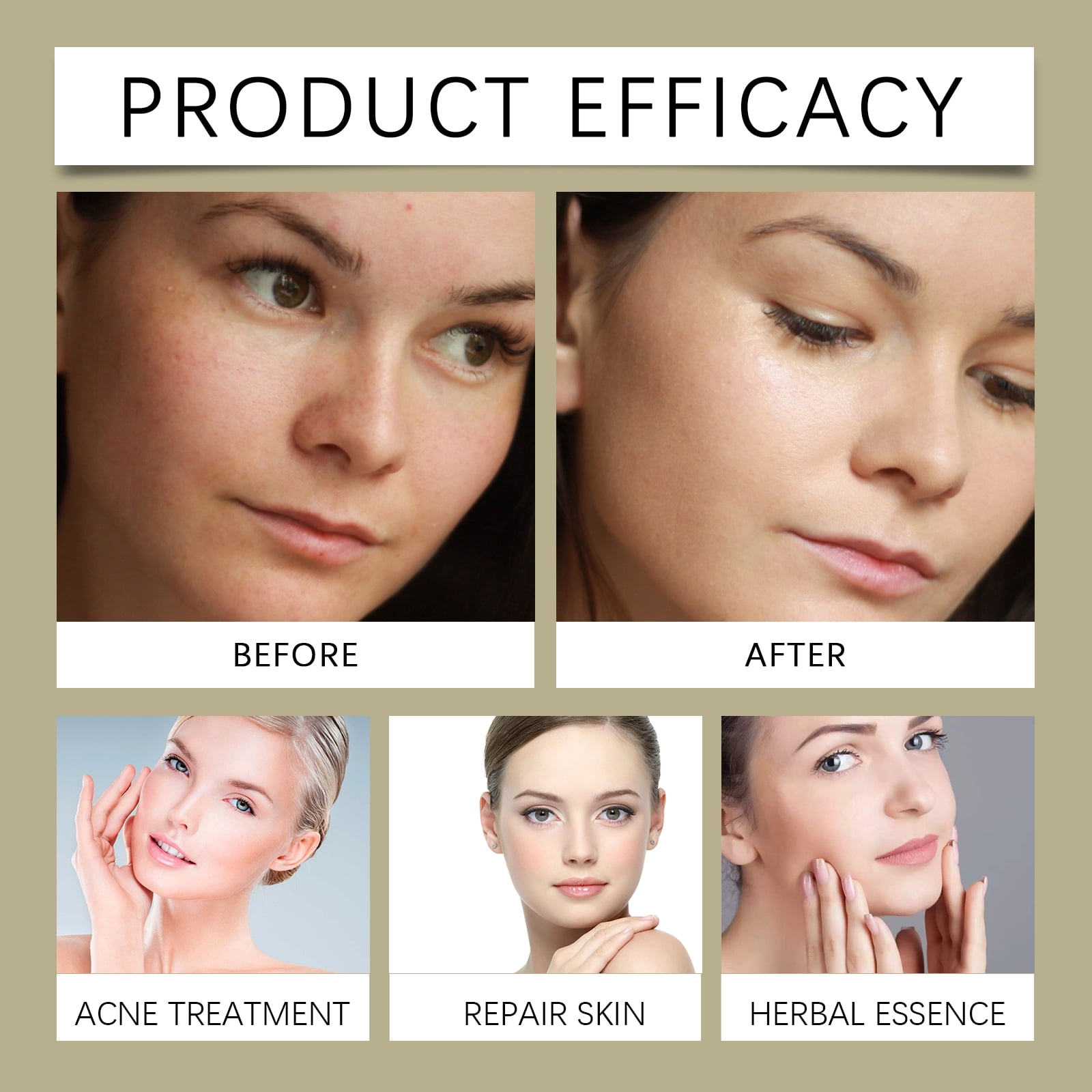 Alvantor Glycolic Acid 7% Facial Toner - Moisturizing, 3.38 fl. oz