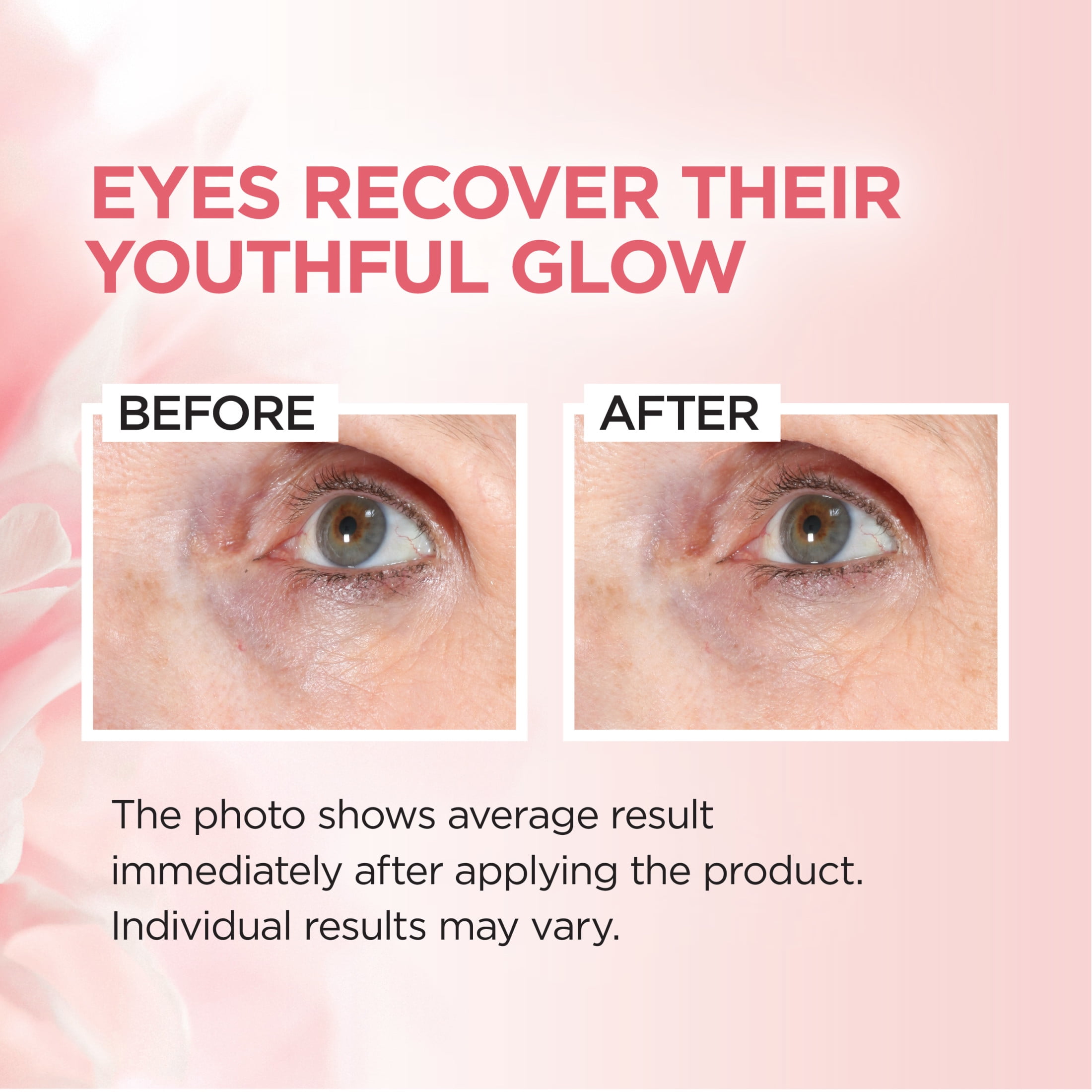 L'Oreal Paris Age Perfect Rosy Tone Brightener Eye Cream, 0.5 fl oz