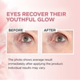 thumbnail image 4 of L'Oreal Paris Age Perfect Rosy Tone Brightener Eye Cream, 0.5 fl oz, 4 of 10