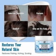 thumbnail image 4 of 1-3x Scalp Soothing Cream - Nourishing Care, Reduces Dandruff & Itch Relief 100ml, 4 of 5