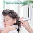 thumbnail image 4 of Smart Ear Wax Removal Cleaner Wireless Visual Endoscope Camera Otoscope NEW D3B6, 4 of 5