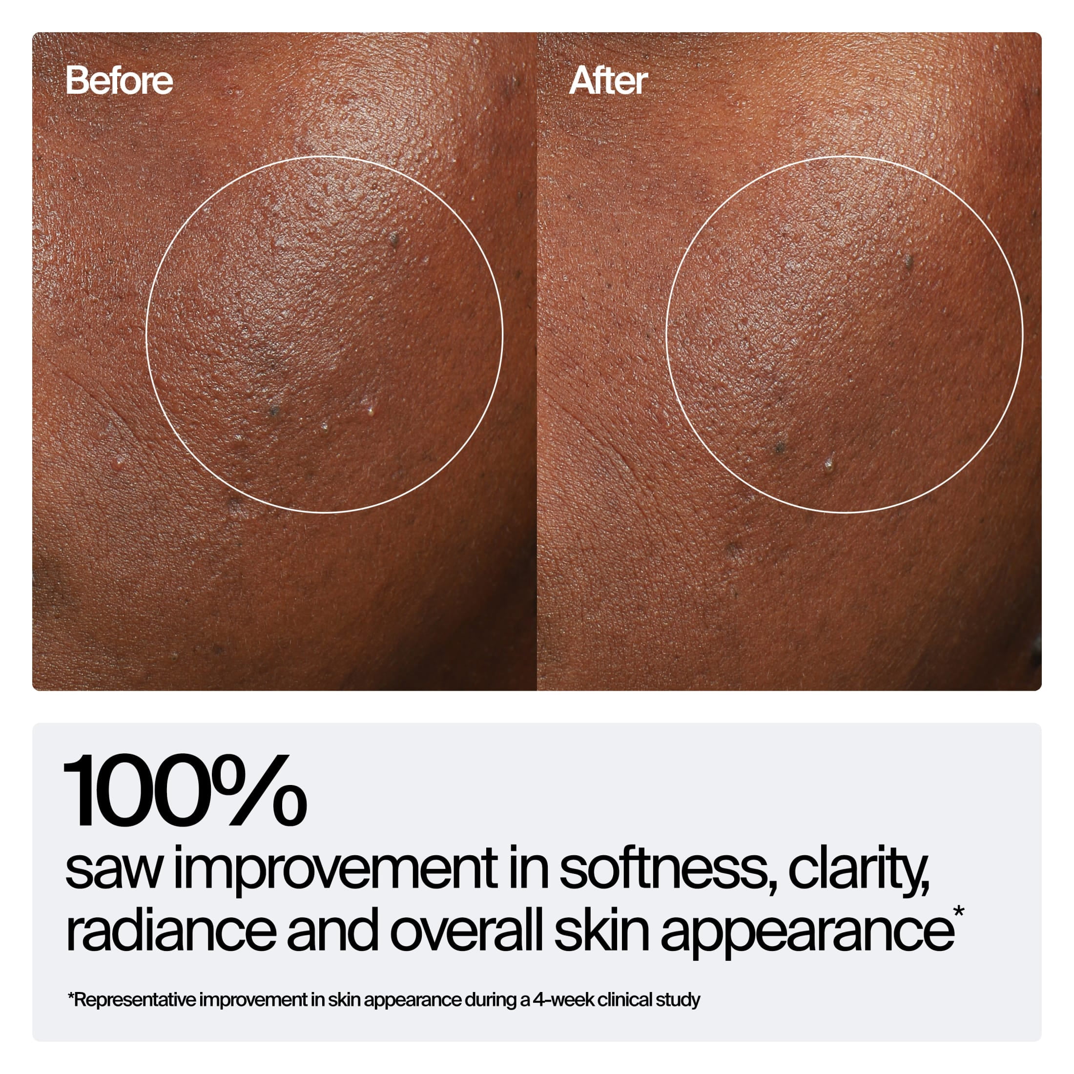 Neutrogena Hydro Boost Hyaluronic Acid Rejuvenating Serum, Skin Barrier Support Face Serum