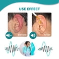 thumbnail image 2 of Las gotas para los oídos naturales de 10 ml alivian eficazmente el dolor de oído y el tinnitus para hombres y mujeres, 2 of 9
