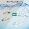 thumbnail image 2 of Ultrasonic Retainer Cleaner, Dental Cleaning Pod with U-V Lights, 45kHz Retainer Cleaner Machine for Dentures, Toothbrush Heads, Jewelry, Aligner, Night Mouth Guards (Black), 2 of 8
