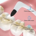 thumbnail image 3 of Tartar Remover, Professional Tooth Cleaning, Tartar Removal For Removing Plaque And Impurities On Teeth, 3 of 5