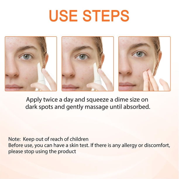 15ml Remove Melasma Pen Remove Dark Spots Melanin Melasma Remover Face Skin Care Ndcxsfigh Cuidado Belleza
