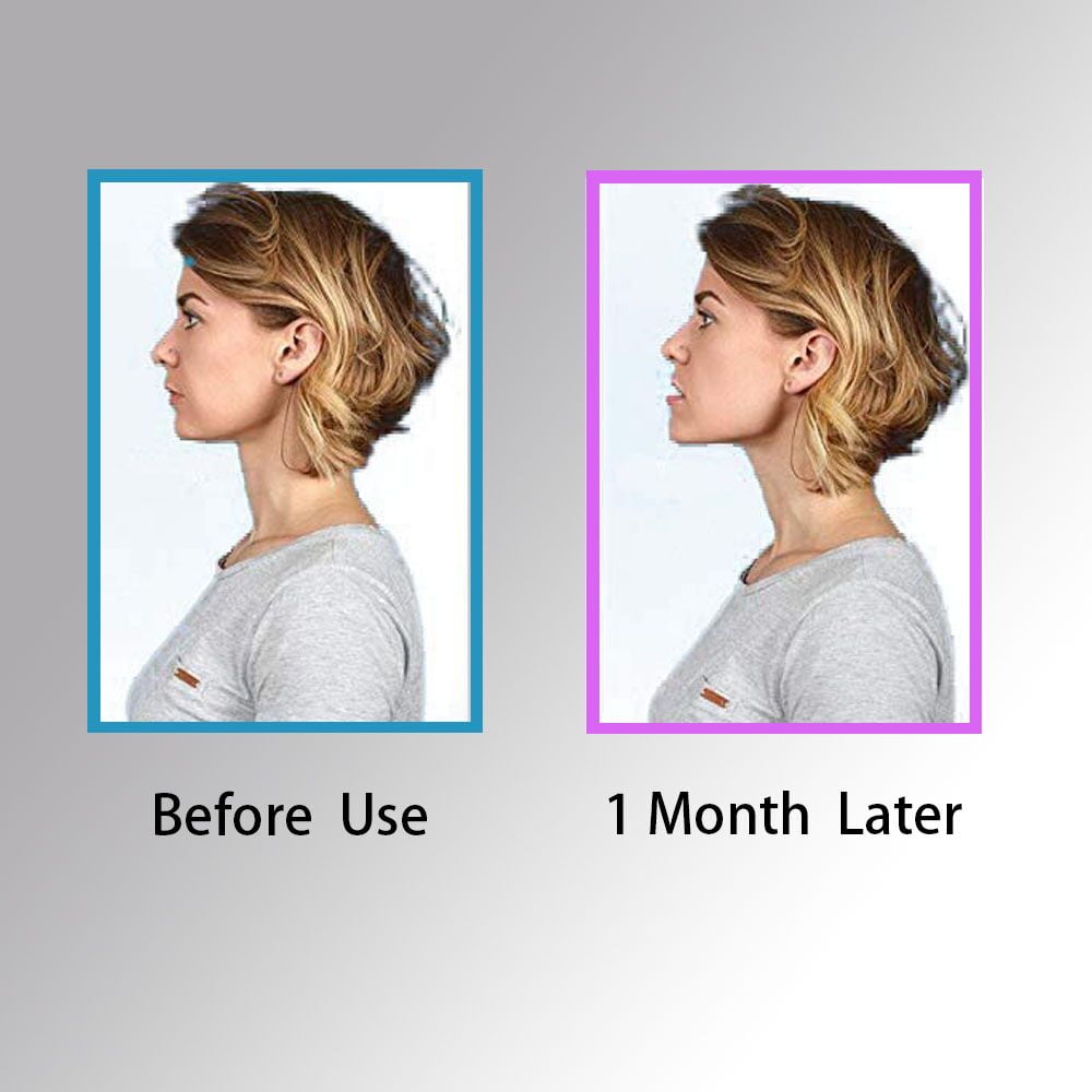 Jaw exercise tool walmart new arrivals