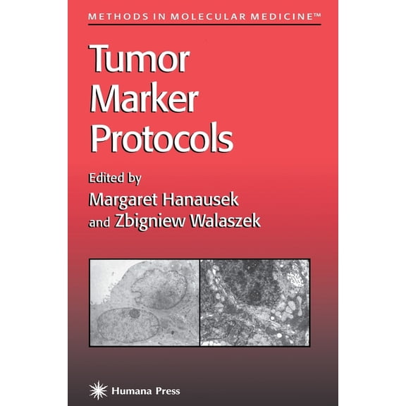 Methods in Molecular Medicine Tumor Marker Protocols, Book 14, (Paperback)