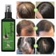 thumbnail image 2 of Líquido para el cuidado del cabello Qian Jaysuing, para fortalecer el cabello y prevenir el masaje de las raíces del cabello, líquido nutritivo para el cuero cabelludo grueso | 120 ml, 2 of 4