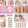thumbnail image 2 of 100 pegatinas correctoras para uñas encarnadas, parches correctores para uñas de los pies, incrustaciones para paroniquia, tratamiento, cuidado y pedicura, Lucky_B, 2 of 4