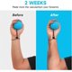 thumbnail image 5 of Set of 2 hand rehabilitation balls for hand exercises, anti-stress balls for adults and kids, 5 of 5