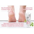 thumbnail image 2 of La crema de ácido salicílico con urea CLEAR 40% +2% suaviza la piel agrietada, 2 of 6